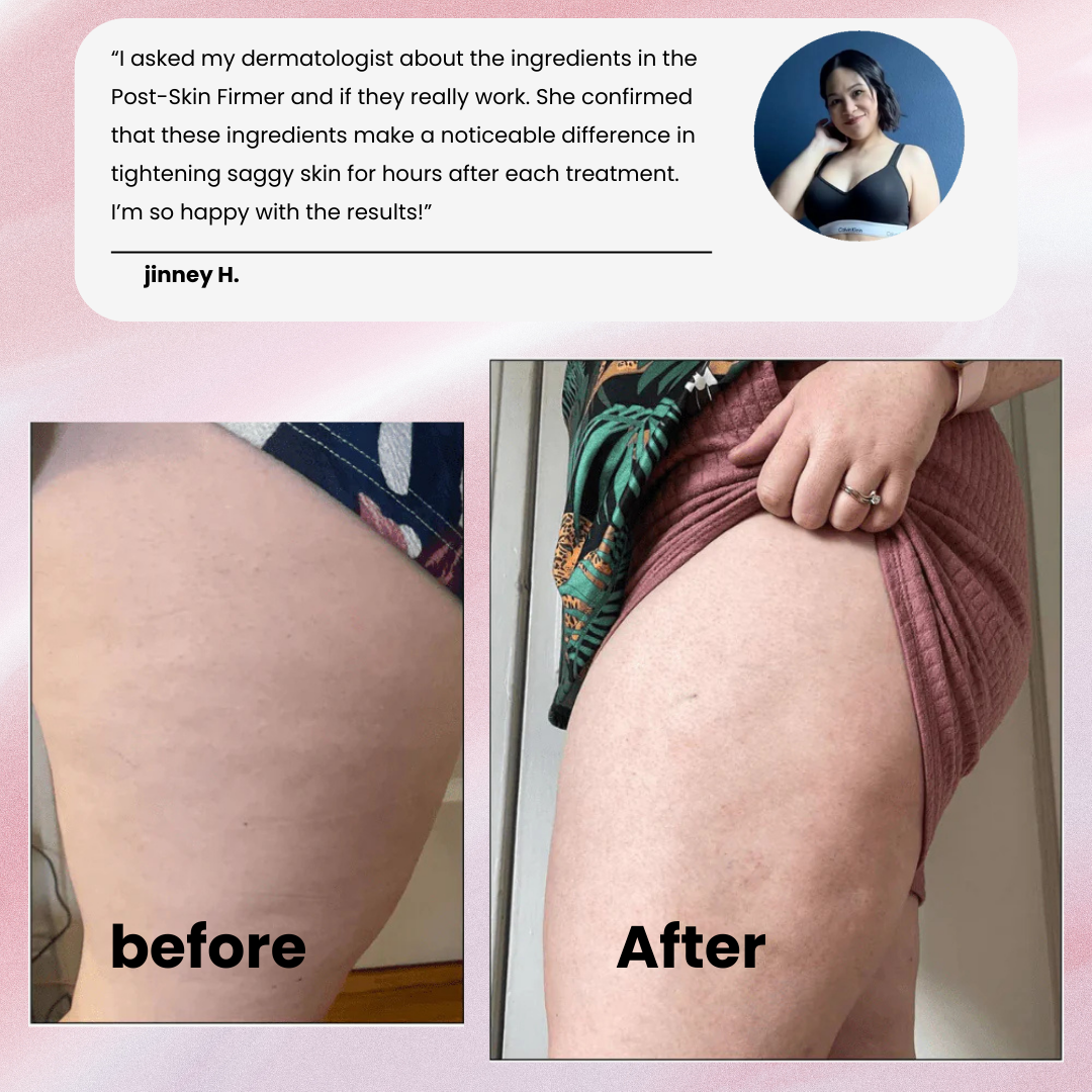 CelluGlow™ Post-Skin Firmer