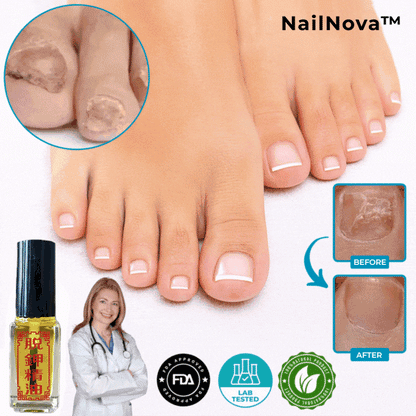 NailNova™ Foot & Nail Repair – Fungal Treatment Oil